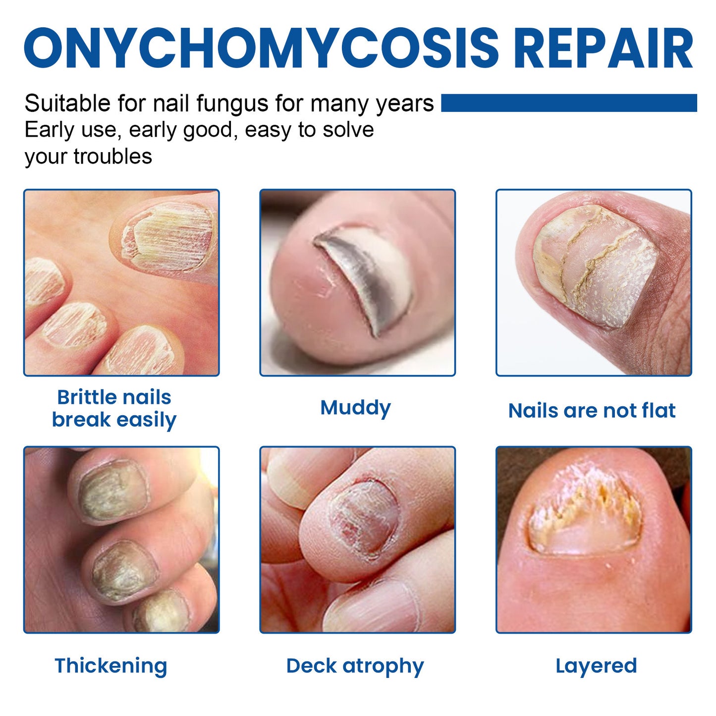 Nail repair patch