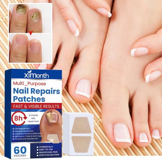Nail repair patch