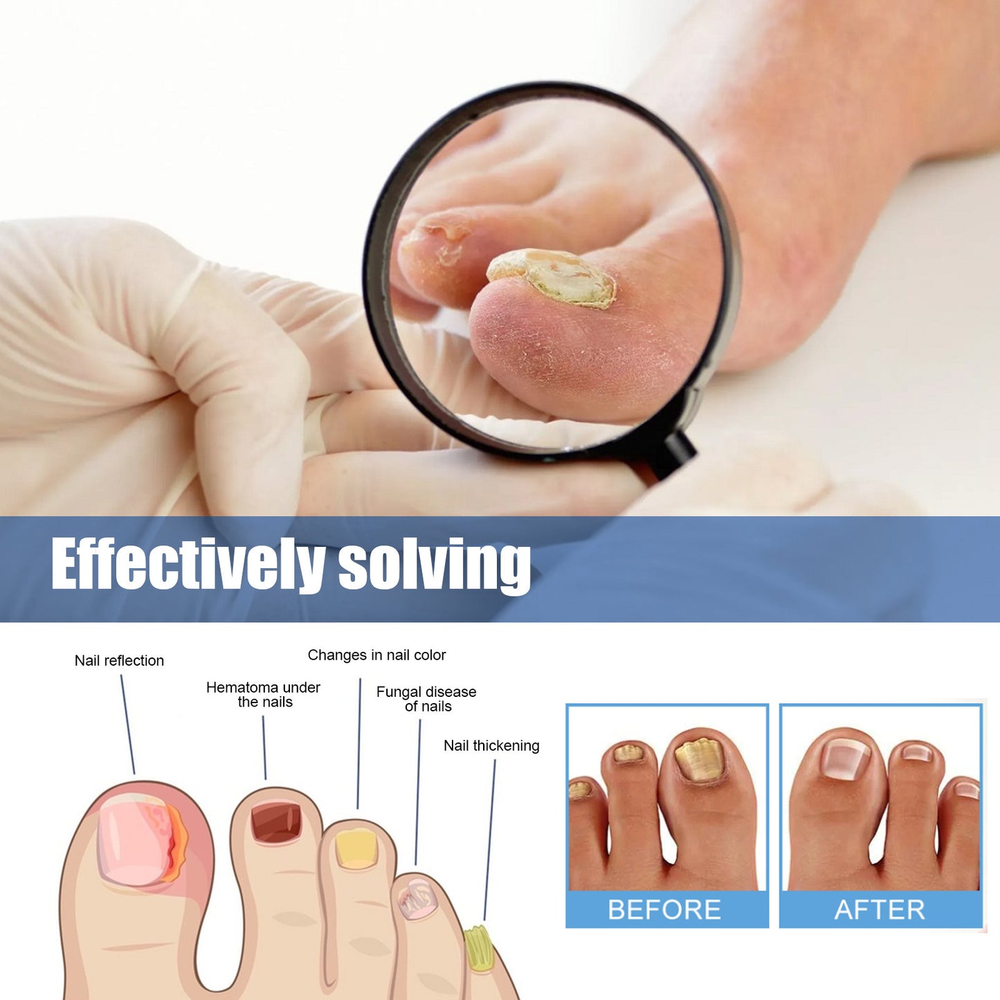 Nail repair patch