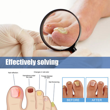 Nail repair patch