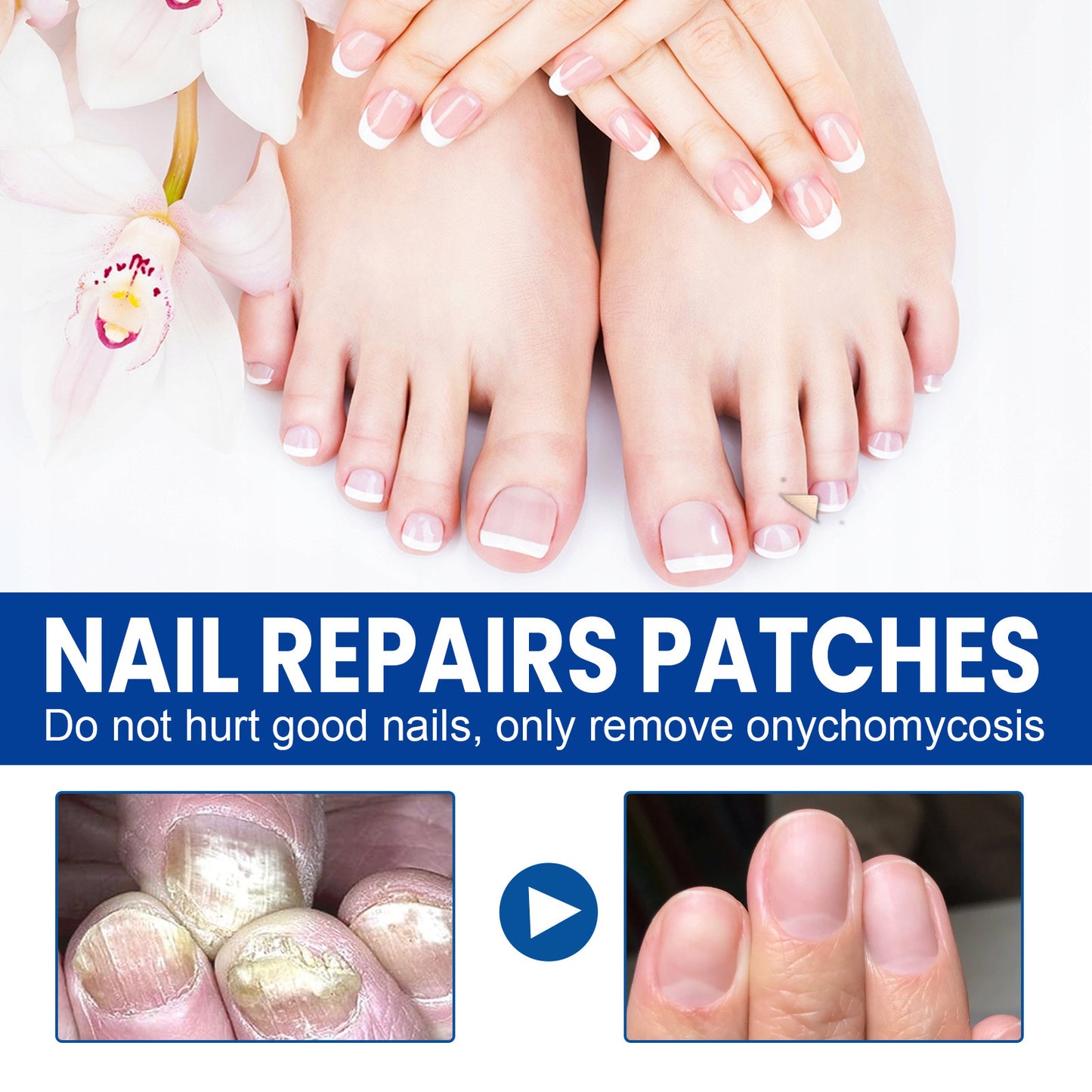 Nail repair patch