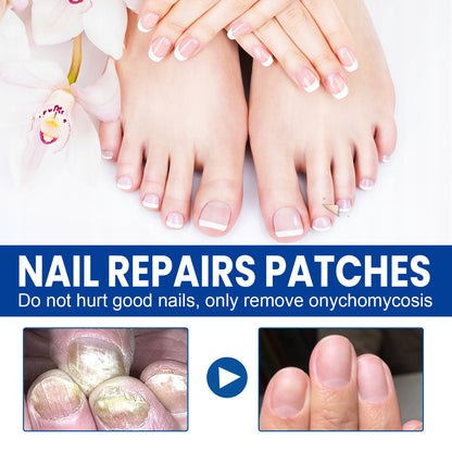 Nail repair patch